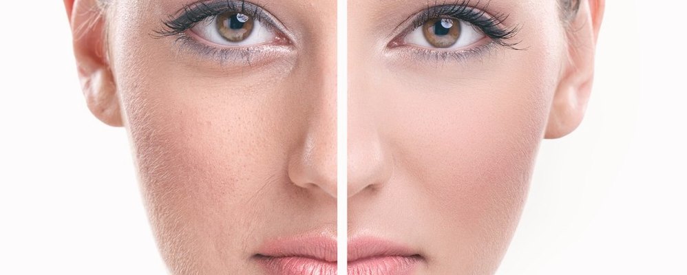 Skin treatment: Before & After
