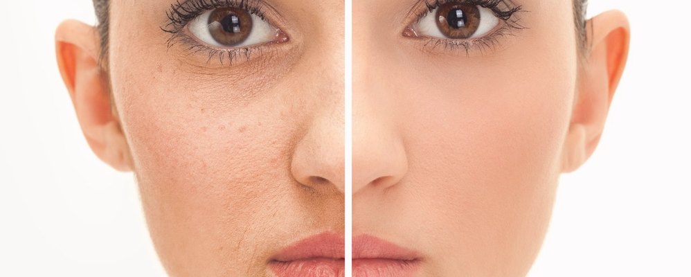 Skin treatment: Before & After